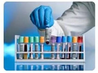 Clculo de existencias de insumos para laboratorios clnicos